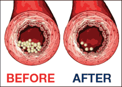 Blood Vessel Example